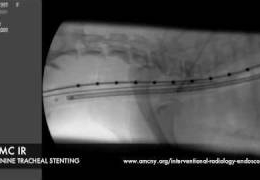 trachstent